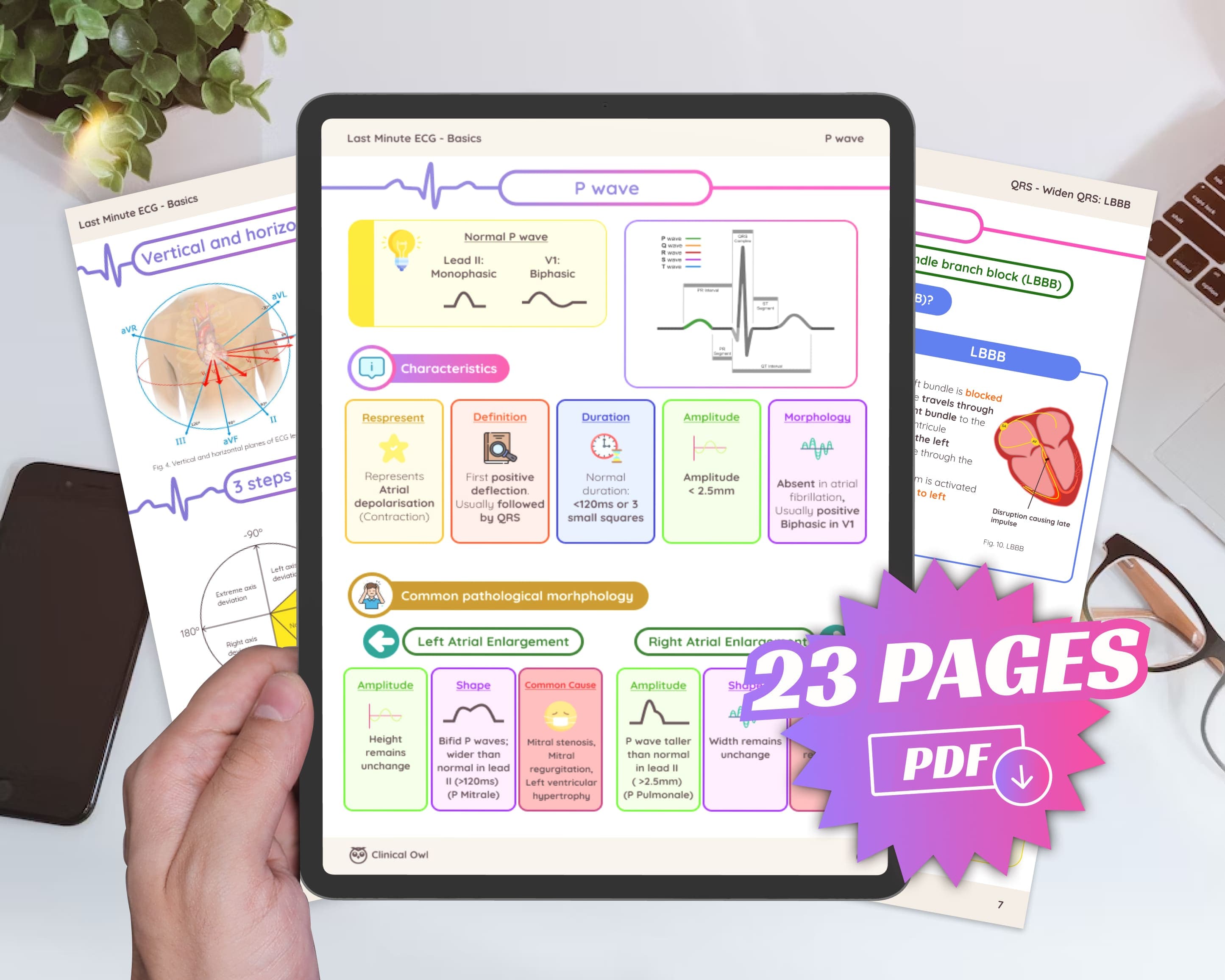23 pages: ECG Essentials Notes